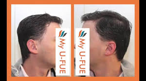 Patrick Mwamba (patrickmwamba)