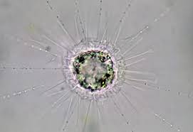 Image result for Raphidiocystis