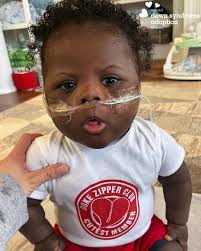 Sweet Caleb is absolutely one of the cutest members of the "zipper club"- a  title affectionately given to those who have undergone open heart surgery  and are rocking their scars! As we