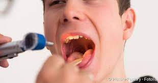 Rachenentzundung Pharyngitis Symptome Therapie Netdoktor