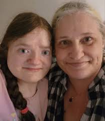 Miraculous Recovery from Seizures in Defiance, OH