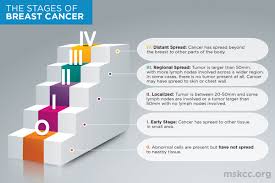 This is determined by the size of the tumour and whether or not the cancer has spread to the lymph nodes or other parts of the body. Stages Of Breast Cancer Memorial Sloan Kettering Cancer Center