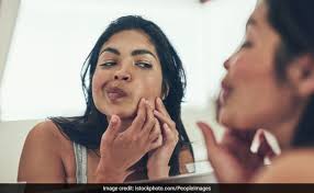 May 9 at 2:12 am ·. How To Get Rid Of Pimples 6 Overnight Diy Remedies To Try At Home