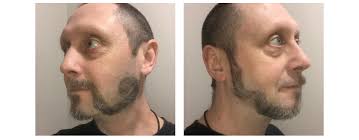 Emerging IT Raise Money For Lymphoma Research