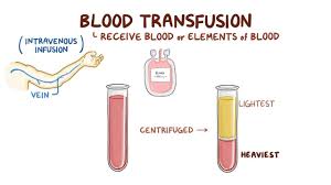 Image result for Plasma Transfusion