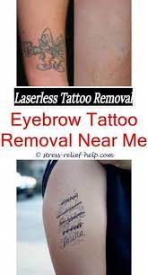 Laser Tattoo Removal Near Me Stages Of Tattoo Removal Healing Can Saline Solution Can Remove Tattoo Removal Cost Temporary Tattoo Ink Eyebrow Tattoo Removal