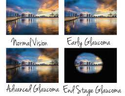 Health care professionals can help their patients understand these. Glaucoma