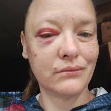 This was my little sister, Allicia. She was bullied to suicide by many  different kids at Orrville High School