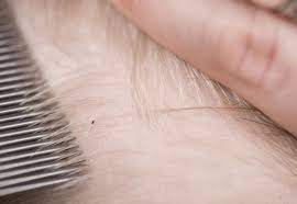 Kopflause Richtig Behandeln Friseur Com