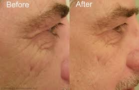 Full Face Beauty Panel Led Light Therapy