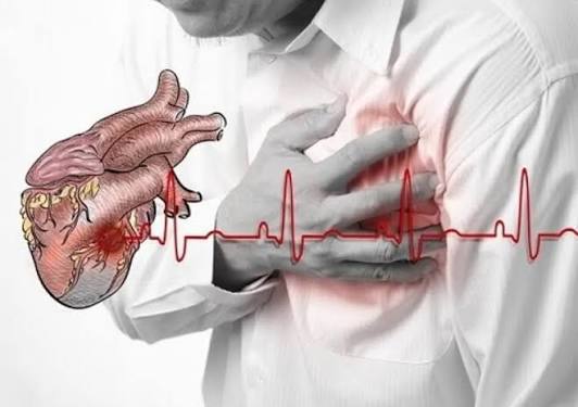 Nhồi máu cơ tim: Dấu hiệu triệu chứng, nguyên nhân và điều trị