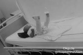 Ia sekaligus mendorong ibu bapa agar mengambil berat terhadap vaksinasi ini. Akhirnya Doktor Sahkan Paha Anak Kecil Ini Patah Dua Lagi Kes Kecuaian Pengasuh