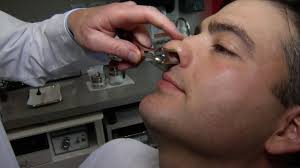 Sinuva Sinus Implant melts away nasal congestion