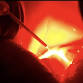 Uses of LASER in Dentistry — The Dental Zone Muscat event image
