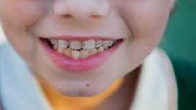 Image result