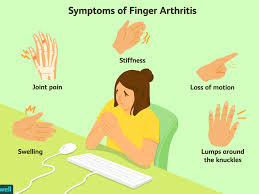 He was a horrible nail bitter. Finger Arthritis Signs Symptoms And Treatment