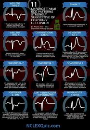 Ekg Infographics Emergency Medicine Nurse Critical Care Nursing