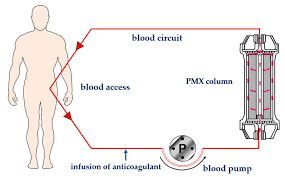 One of the most concerning indicators that your septic tank is in need of an immediate pumping is slow or gurgling drains. Ijms Free Full Text Therapeutic Rationale For Endotoxin Removal With Polymyxin B Immobilized Fiber Column Pmx For Septic Shock Html
