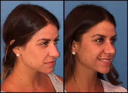 Barry M. Weintraub MD: Surgeons in Manhattan Borough, New York County