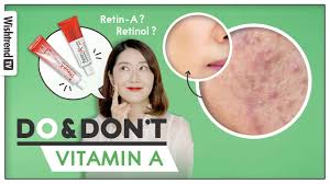 All About Vitamin A Cream Retinol Retinoid Cure For Acne Fine Lines W O Side Effects Youtube Retinol may also help unclog pores, according to the american osteopathic college of dermatology. all about vitamin a cream retinol retinoid cure for acne fine lines w o side effects