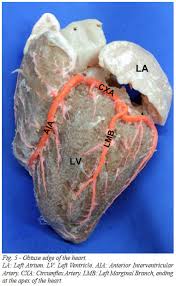Typically, the lad branches off the left main (lm) coronary artery. Braz J Cardiovasc Surg Morphologic Expression Of The Left Coronary Artery In Pigs An Approach In Relation To Human Heart