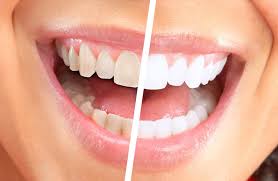 Star Dental Group | Santa Barbara CA