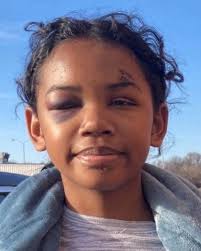 UPDATE: According to APD's Kailey was located. Thank you for sharing and  engaging in this post. 🚨 MISSING