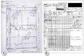 aims should we aim higher anesthesia patient safety