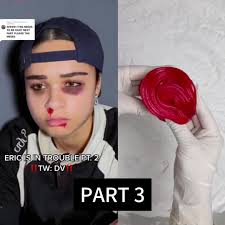 Why Was Eric Having Trouble Mic