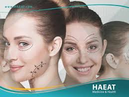 أحدث عمليات التجميل للوجه | 5 تقنيات بدون جراحة