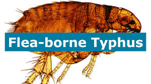 Image result for Typhus