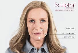Safety and effectiveness of sculptra® aesthetic have not been evaluated in areas other than nasolabial wrinkles and folds in clinical trials. Columbus Sculptra Juvederm Voluma Cheek Filler Volume Treatment