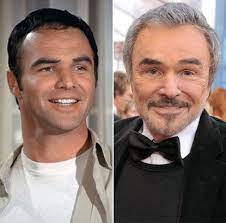 While some say that he can be seen as an example of plastic surgery … Chatter Busy Burt Reynolds Plastic Surgery Burt Reynolds Plastic Surgery Celebrity Plastic Surgery