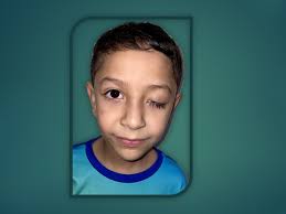 Fundraiser by Mabeth Jimenez : Help Mateo´s operation