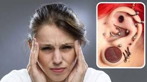 My name is Leisel. I've had chronic migraines for 30+ yrs, a Daith for 8  yrs. I'm doing research