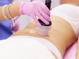 FBS – Facial and Body Sculpting