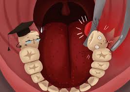 When Can I Stop Worrying About Dry Socket In 2020 Dry Socket Stop Worrying Bad Teeth