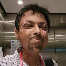 Nikhil Autar: NSW Young Australian of the Year Redefining Resilience and  Inclusivity