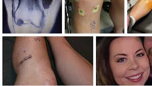 Fundraiser by Monica Gordon : Limb and life-saving procedures & medical  expenses