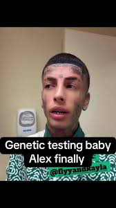 Is Baby Alex A Dwarf