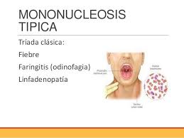 La mononucleosis infecciosa es una enfermedad provocada por un virus de la familia de los herpes. Mononucleosis Infecciosa O Laboratorio Orotina Facebook