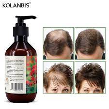 The case is different when it comes to organic hair dyes, though. Anti Hair Loss Shampoo Thick Fast Hair Growth Hair Restore Treatment Organic Hair Regrowth Protein Product Hair Loss Products Aliexpress