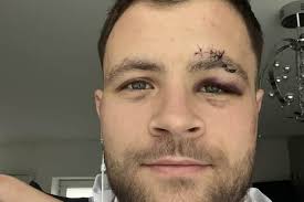 Blackpool boxer and Seasiders fan explains why he ditched football to  pursue his career in the ring ahead of Winter Gardens fight