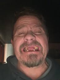 Fundraiser by Mike Bowman : Help Mike Restore His Smile and Confidence