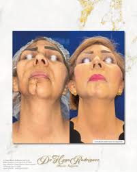 Dr. Hugo Rodriguez Cirugía plástica, estética y Reconstructiva added a new  photo — at Centro Medico de Especialidades de Ciudad Juarez SA...