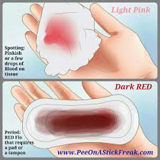 Light pink discharge in women is merely a mixture of blood with your vaginal discharge. Pin On Pregnancy And Fertility