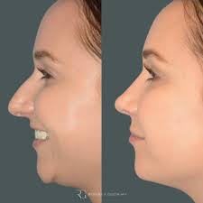 Robert A. Guida,MD (@drguida) • Instagram photos and videos