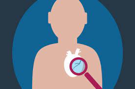 What does cardiac arrest mean? Sudden Cardiac Arrest 5 Things Raise Your Risk Cleveland Clinic