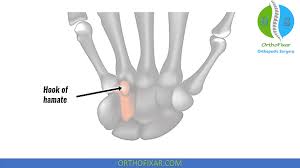 Image result for Hamate Bone