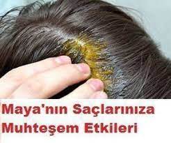 Kadinlara Dair Ne Varsa Hair Loss Therapy Hair Loss Treatment Natural Hair Loss Treatment